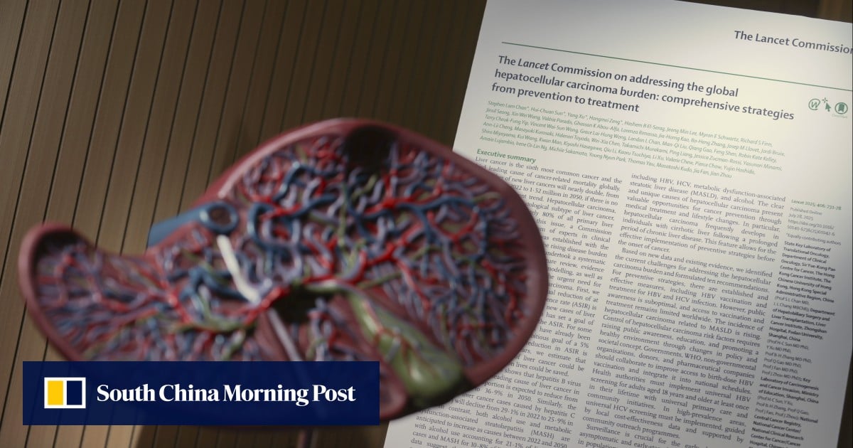 Lifestyle fixes can curb doubling of liver cancer cases by 2050: Hong Kong experts